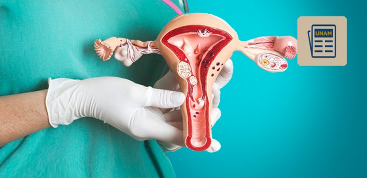 Cáncer de Ovario Epitelial es el más letal entre los cánceres ginecológicos Cáncer de Ovario Epitelial es el más letal entre los cánceres ginecológicos