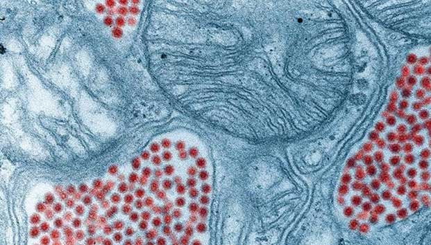 Detectan raro virus capaz de provocar daños cerebrales