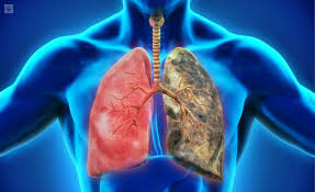 Amgen presenta datos clínicos del nuevo inhibidor del gen kras g12c , en fase de investigación, en pacientes con tumores sólidos en Congreso de Esmo 2019