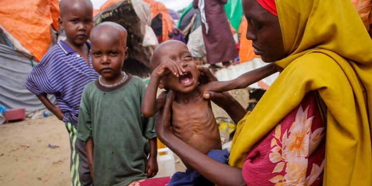 Casi un millón de personas en el mundo están amenazadas por “hambruna catastrófica”: ONU