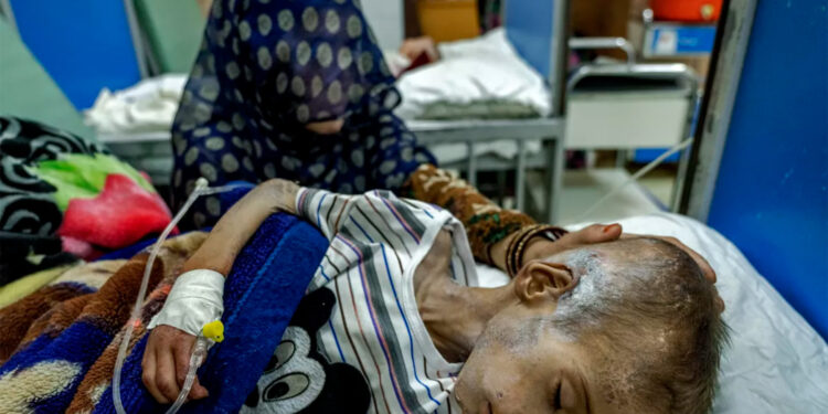 El hambre provoca una muerte cada cuatro segundos, alertan más de 200 ONG