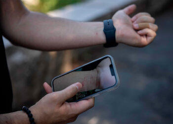 Viruela del mono: Hay mil 367 casos confirmados en México