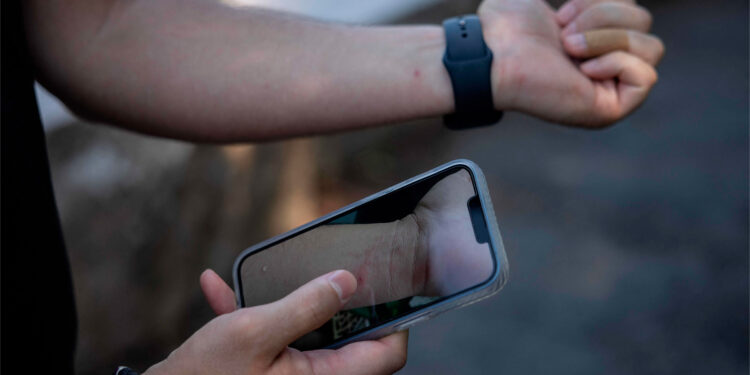 Viruela del mono: Hay mil 367 casos confirmados en México