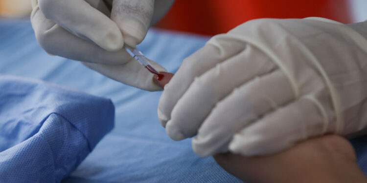 Una de cada cuatro personas a nivel mundial padeció anemia en 2021: The Lancet