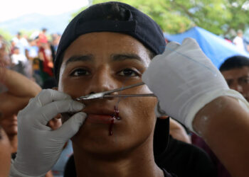 Migrantes en Chiapas se cosen la boca para pedir documentos de tránsito