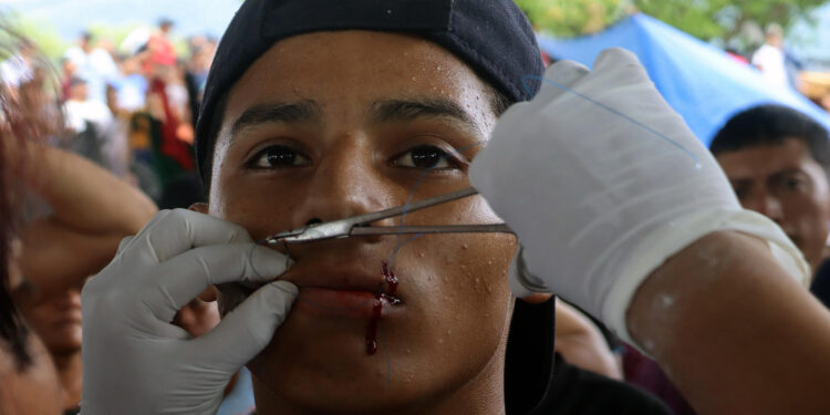 Migrantes en Chiapas se cosen la boca para pedir documentos de tránsito